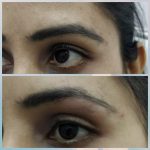 Eyebrow Lift Treatment in Bandra,Mumbai