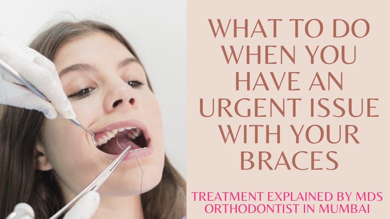 Read more about the article What to do when you have an urgent issue with your Braces? What to do if you brace breaks?