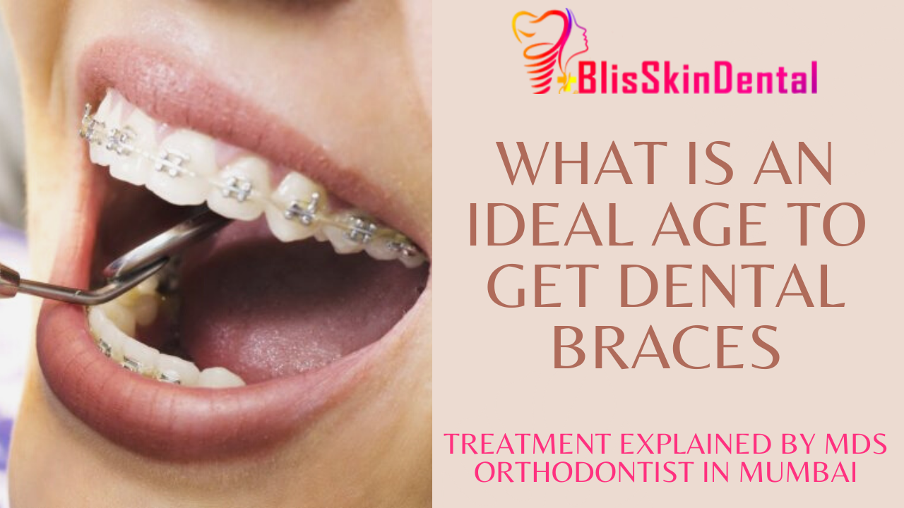 You are currently viewing What is an ideal age to get Dental Braces? What should you know before getting braces?