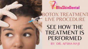 Read more about the article Live Procedure of Botox Treatment in Mumbai