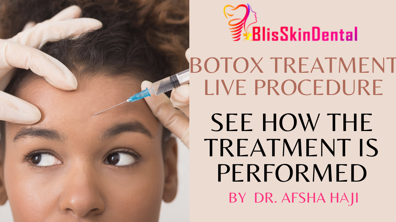Read more about the article Live Procedure of Botox Treatment in Mumbai
