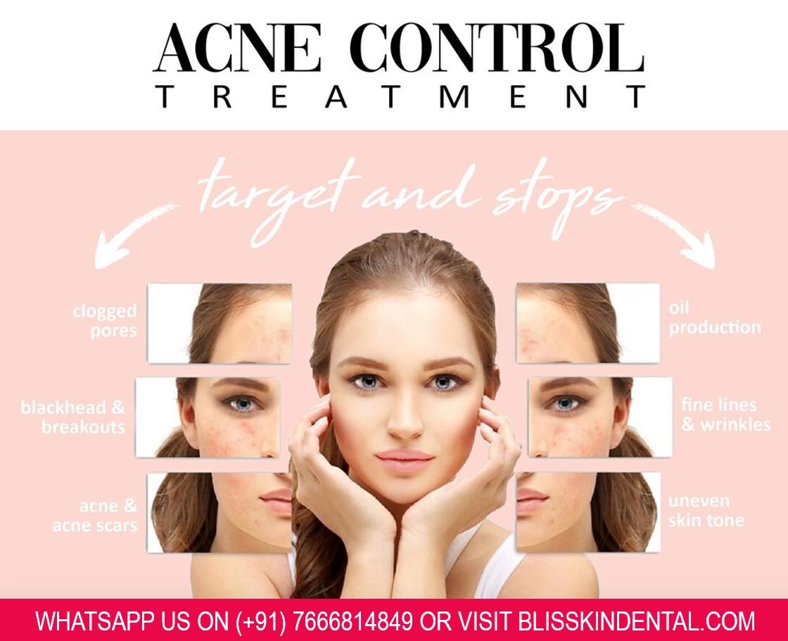 Read more about the article Clogged pores, Oil Production, Blackhead & Breakouts, Acne & Acne Scars, Fine Lines & Wrinkles and Uneven Skin tone Treatment in Bandra