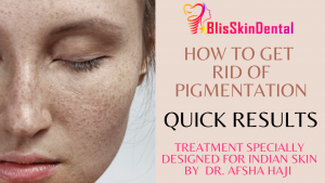 Read more about the article Intralesional therapy for melasma and pigmentation now at Bliss Skin Treatment Clinic Bandra, Mumbai