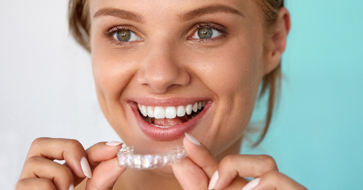 Read more about the article THINGS I WISH I KNEW BEFORE I GOT INVISALIGN