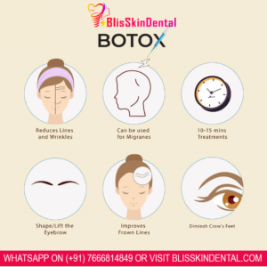 Read more about the article Benefits of getting Botox Treatment