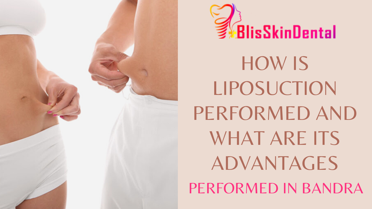 You are currently viewing How is Liposuction done watch live surgery video at Bliss Clinic in Bandra Mumbai