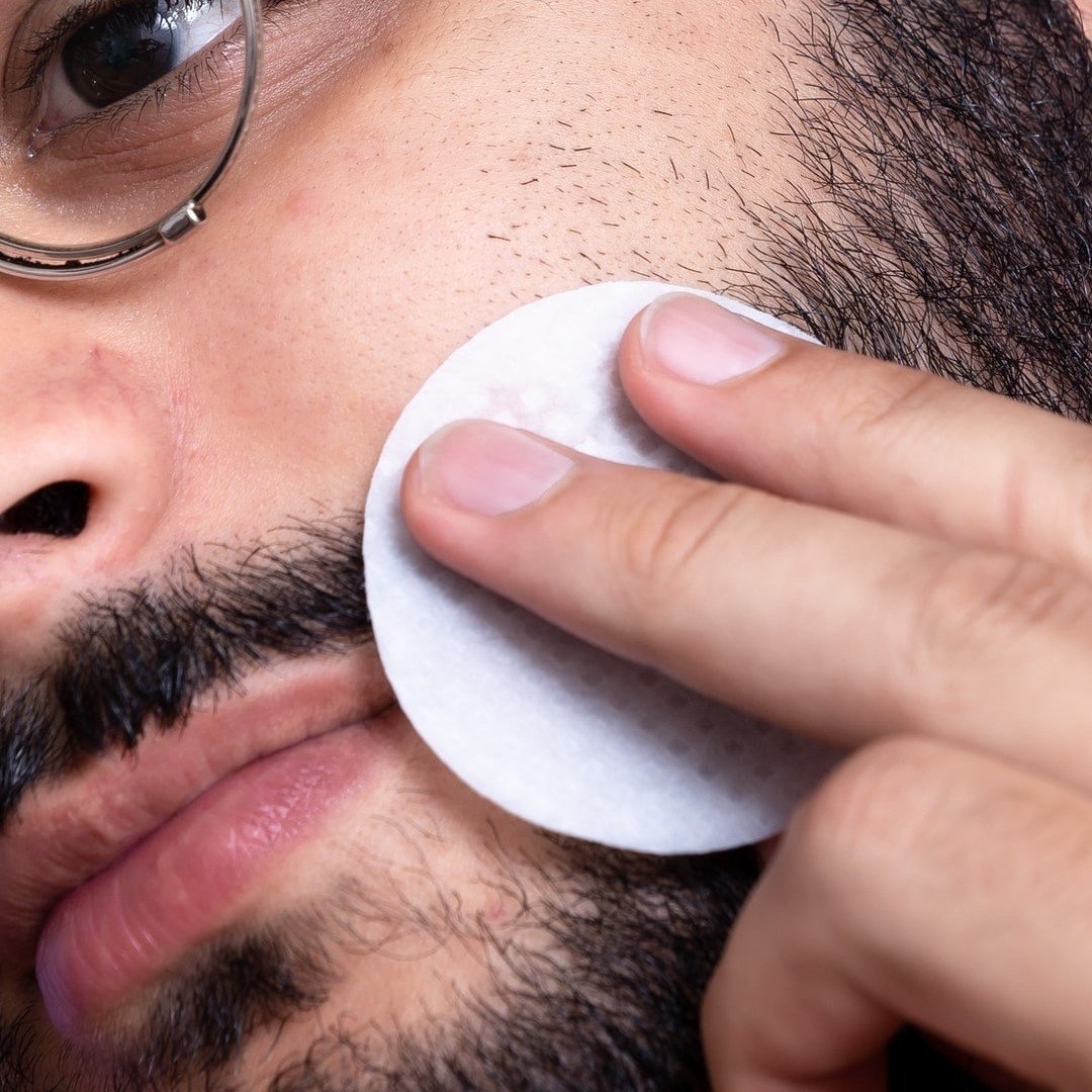 Facial Laser Hair Removal for Men's Beard at Bandra,Mumbai