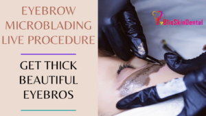 Read more about the article Eyebrow Microblading in Bandra Mumbai at Bliss Eyebrow Enhancement Clinic