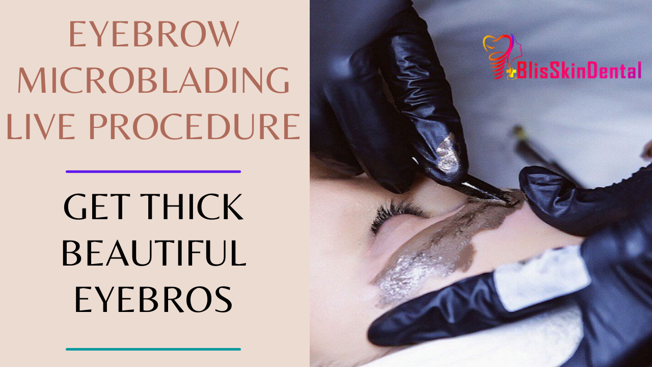 You are currently viewing Eyebrow Microblading in Bandra Mumbai at Bliss Eyebrow Enhancement Clinic