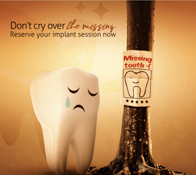 Read more about the article Missing Tooth Treatment at Bliss Dental Clinic in Bandra Mumbai