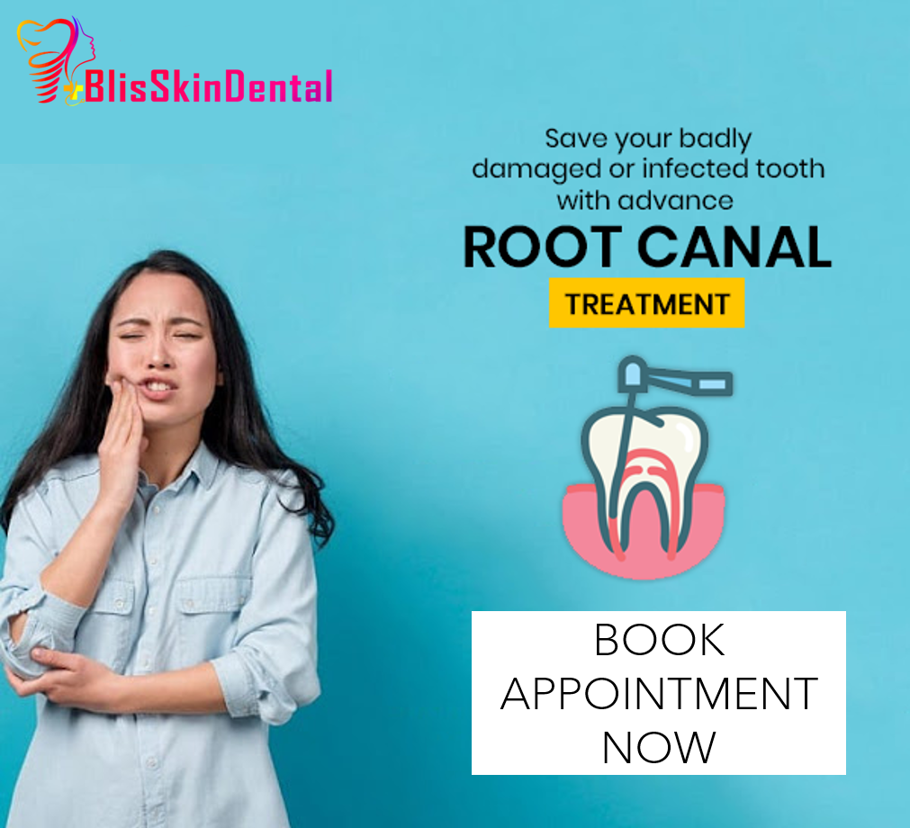 Read more about the article Root Canal Treatment In Bandra, Mumbai | Cost for Root Canal in Bandra