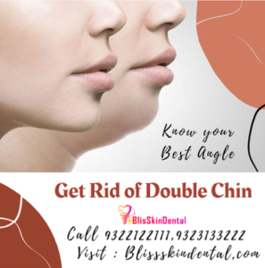 Read more about the article Get Rid of DOUBLE CHIN with Bliss Skin Clinic in Bandra, Mumbai