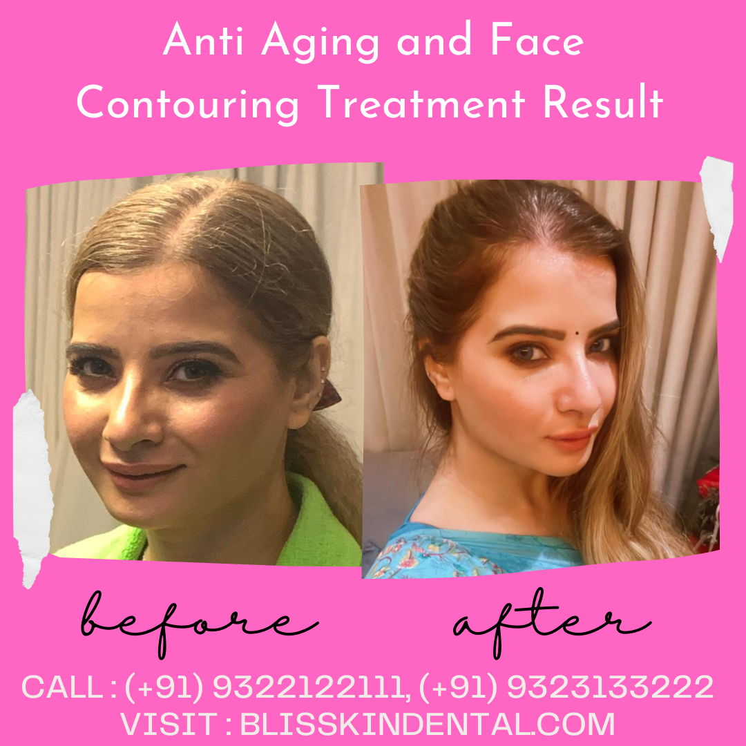 Read more about the article Anti Aging Face Contouring Treatment at Bandra in Mumbai