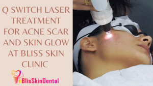 Read more about the article Q Switch Laser Treatment for Acne Scar and Skin glow at Bliss Skin Clinic