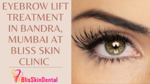 Read more about the article Eyebrow Lift Treatment in Bandra,Mumbai at Bliss Skin Clinic