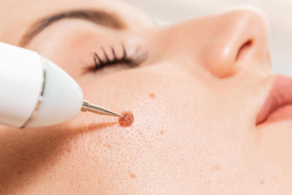 Cosmetic Dermatology in Bandra - Bliss Clinic