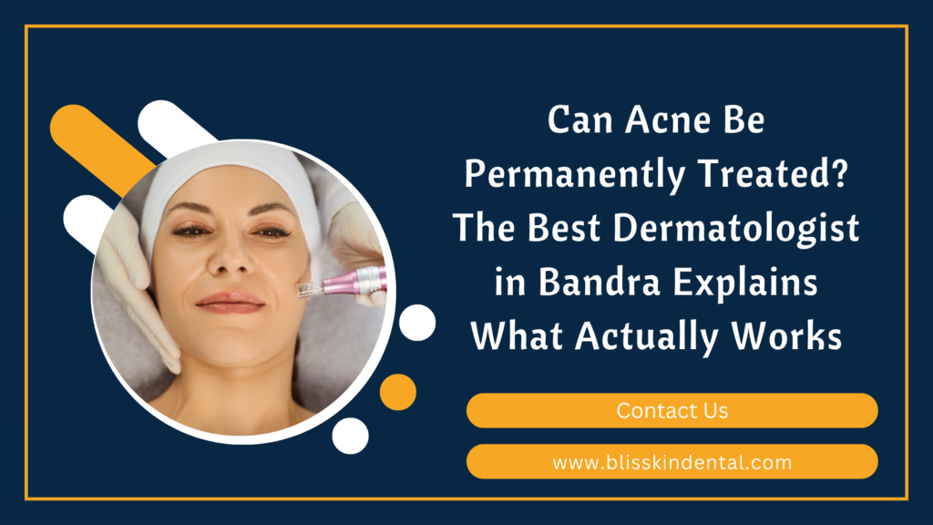 Can Acne Be Permanently Treated? The Best Dermatologist in Bandra Explains What Actually Works
